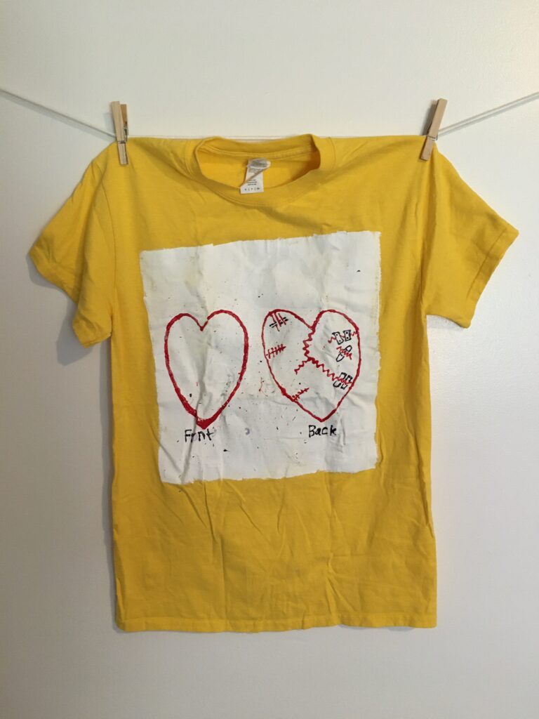 (picture of whole heart and a picture of another heart with stitches) Front Back